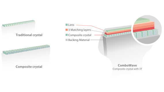 Mindray DC-70 Ultrasound System with X-Insight Technology for Precision Imaging
