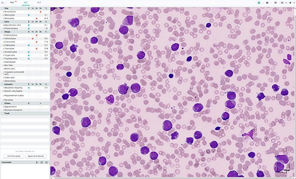 MC-80 Automated Digital Cell Morphology Analyzer - High-Resolution Blood Cell Analysis Device