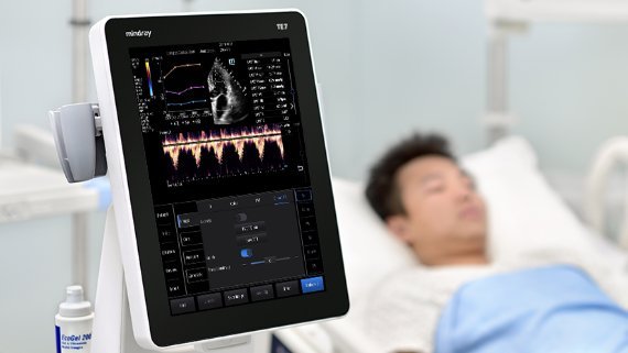Mindray TE7 ACE Ultrasound Machine for Anesthesia, Critical Care, and Emergency Applications
