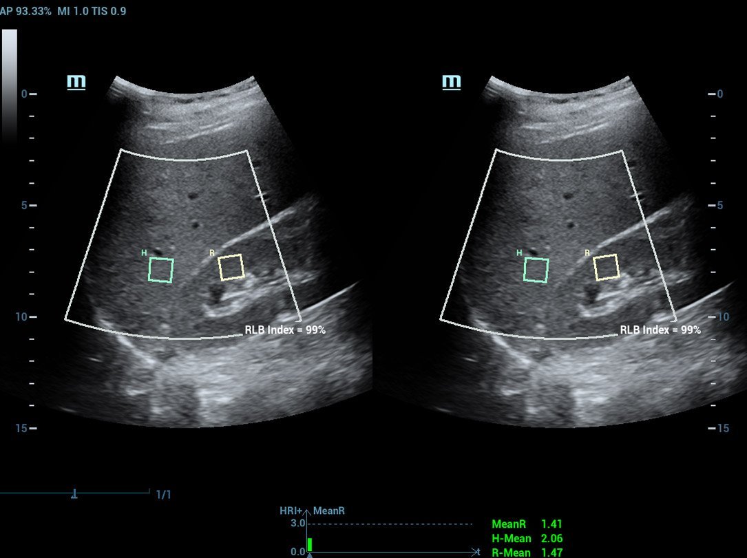 Resona R9 Platinum Edition Premium Ultrasound System for Radiology and Multi-Parametric Imaging Solutions