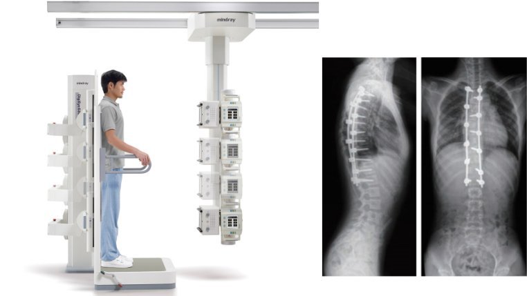 DigiEye 680 Digital Radiography System - Versatile Medical Imaging Solution