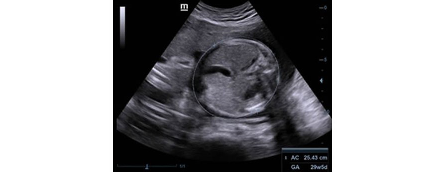 Z50 Color Doppler Ultrasound Machine