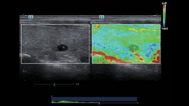 Mindray DC-40 Full HD Diagnostic Ultrasound System