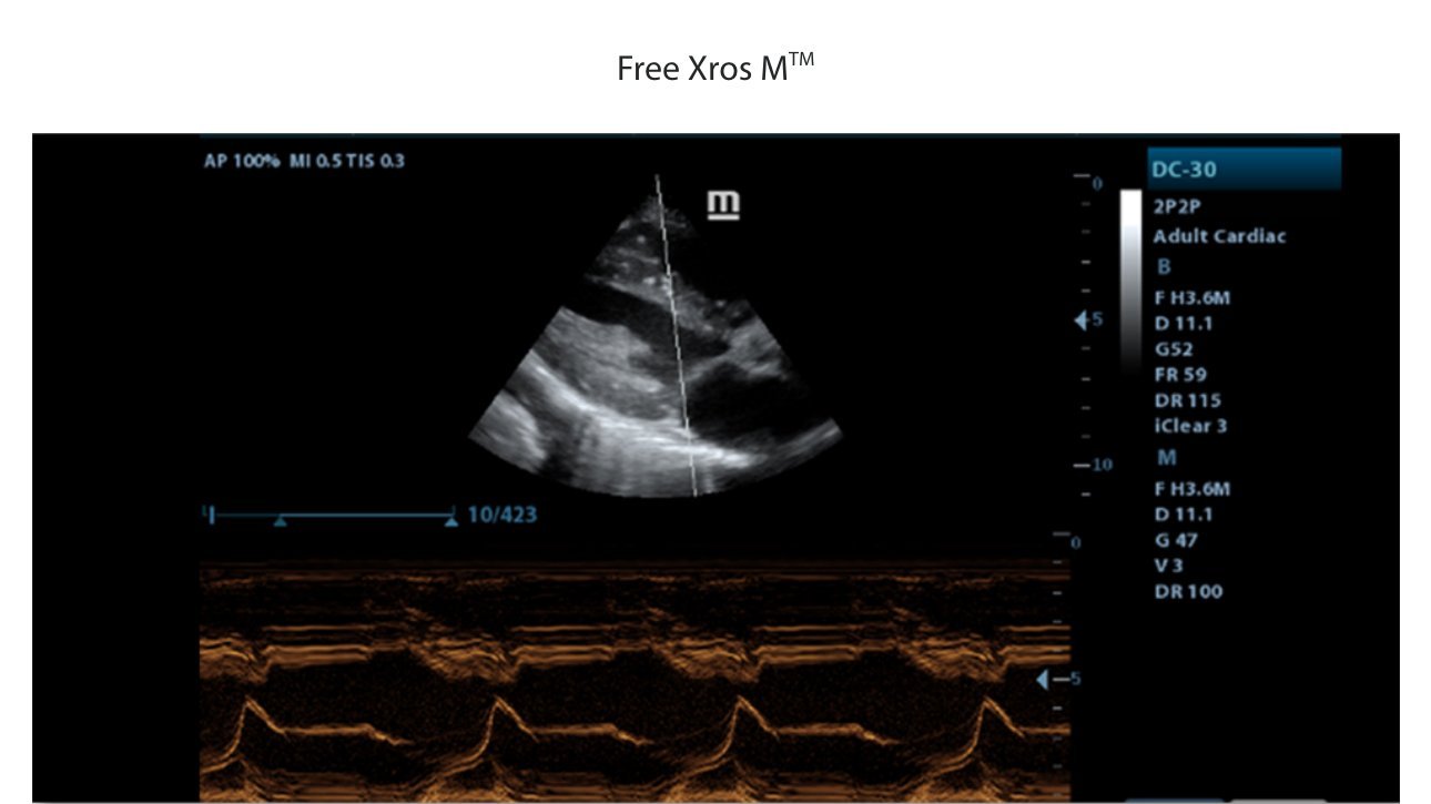 DC-30 FullHD Ultrasound System for Enhanced Diagnostic Imaging