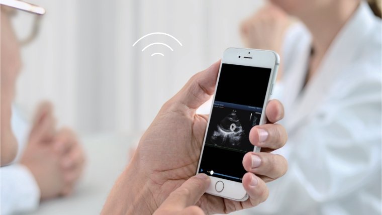Mindray DC-60 ECHO Ultrasound System with X-Insight Technology for Enhanced Imaging and Clinical Efficiency