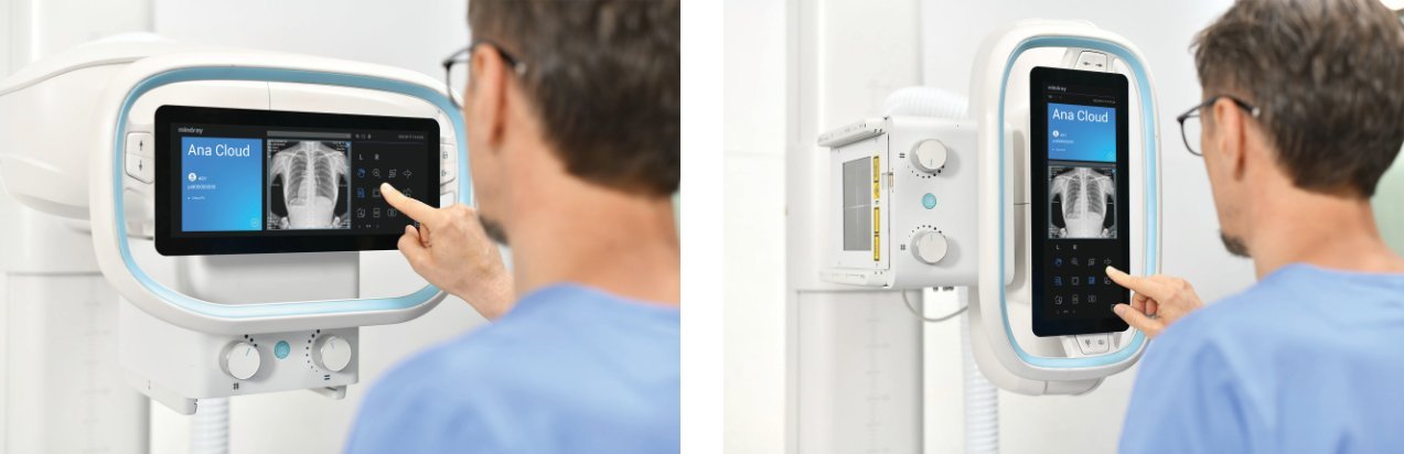 DigiEye 350 Digital Radiography System - Advanced Imaging Solution for Enhanced Medical Diagnostics