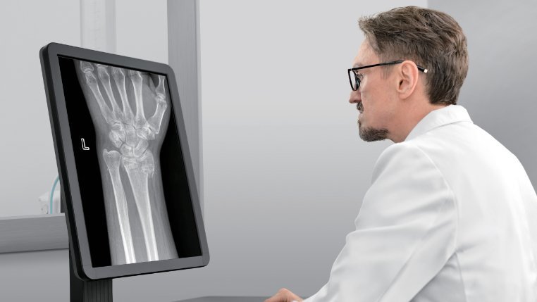 DigiEye 680 Digital Radiography System - Versatile Medical Imaging Solution