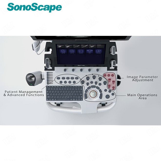 Sonoscape 4D Scan Doppler Ultrasound Machine P50
