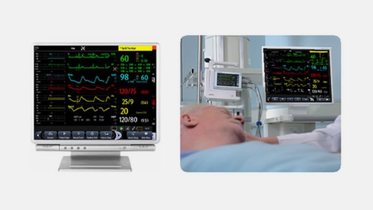 BeneView TDS Adaptive Modular Patient Monitoring System