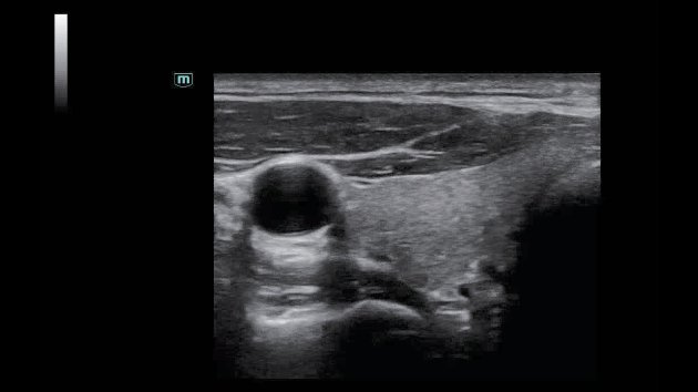 Consona N6 Comprehensive Imaging Solutions - Advanced Ultrasound Technology for General Imaging, Women's Health, and Cardiovascular Applications
