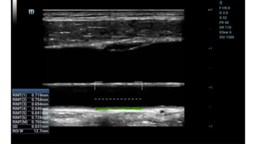 MX7 Ultrasound System - Advanced Mobile Imaging Solution