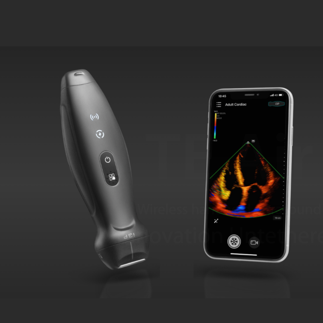 TE Air Wireless Handheld Ultrasound System - Mindray Portable POCUS Device for Emergency and Critical Care