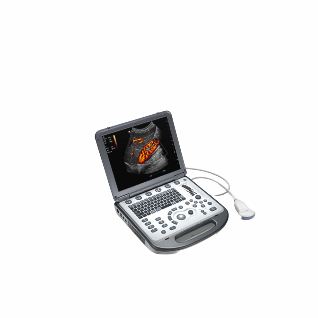 Mindray M6 Ultrasound System - Compact, Portable, and High-Performance Diagnostic Tool