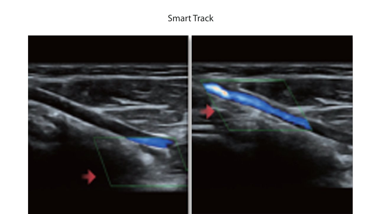 DC-30 FullHD Ultrasound System for Enhanced Diagnostic Imaging