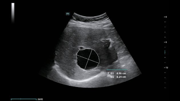 Consona N6 Comprehensive Imaging Solutions - Advanced Ultrasound Technology for General Imaging, Women's Health, and Cardiovascular Applications