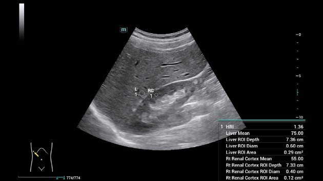Consona N6 Comprehensive Imaging Solutions - Advanced Ultrasound Technology for General Imaging, Women's Health, and Cardiovascular Applications