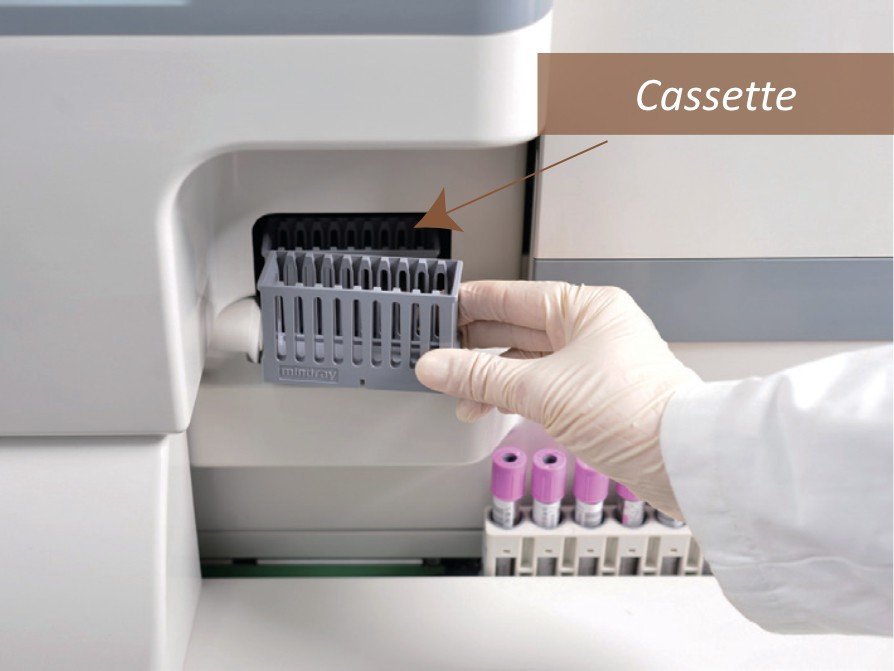 Mindray SC-120 Automated Blood Smear Preparation Device with High-Durability Sapphire Glass Spreader
