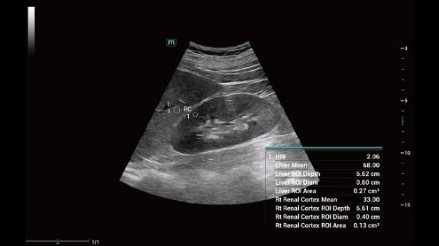 Consona N7 Comprehensive Imaging Ultrasound Device
