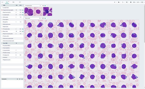 MC-80 Automated Digital Cell Morphology Analyzer - High-Resolution Blood Cell Analysis Device