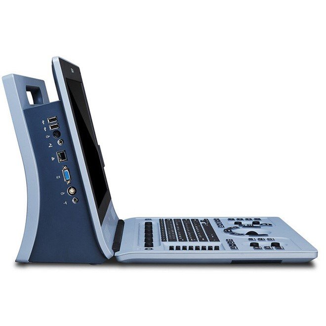 Diagnostic Ultrasound System U60