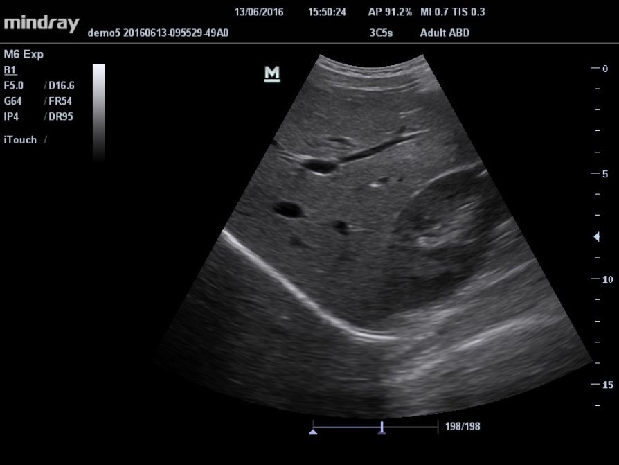 Mindray M6 Ultrasound System - Compact, Portable, and High-Performance Diagnostic Tool