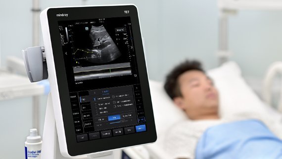Mindray TE7 ACE Ultrasound Machine for Anesthesia, Critical Care, and Emergency Applications