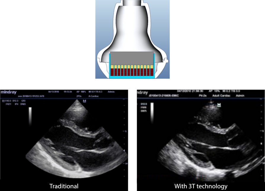 Mindray M9 Ultrasound System - Premium Imaging with Advanced Transducer Technology