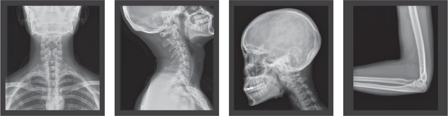 DigiEye 280 Digital Radiography System - Advanced Floor-Mounted DR Solution