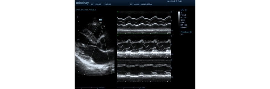 Mindray M9 Ultrasound System - Premium Imaging with Advanced Transducer Technology