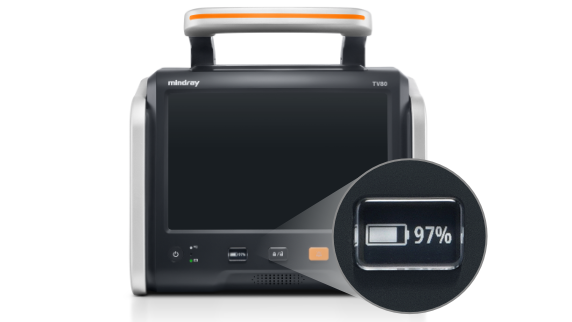 TV80 Portable Transport Ventilator with Advanced Patient Monitoring, Oxygen Management, and Telemedicine Capabilities