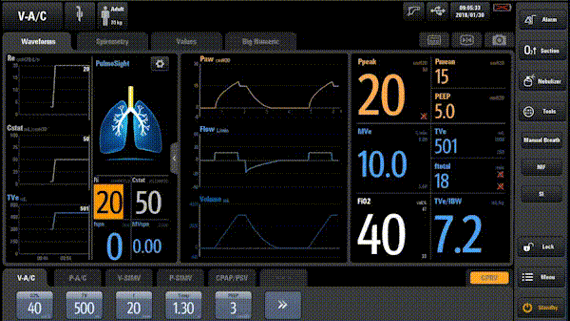 SV800/SV600 High-End Ventilator with Advanced User Interface and Intelligent Decision Support Tools for Clinical Efficiency and Lung Health Monitoring