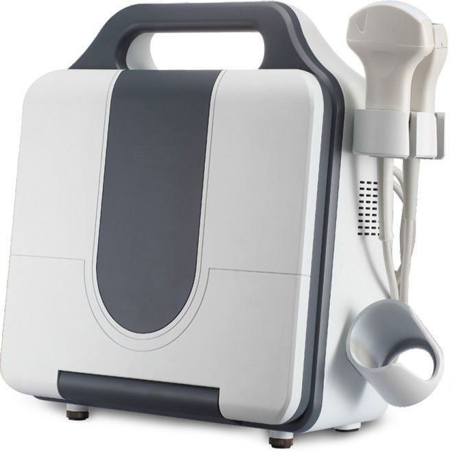 Portable Digital Laptop Ultrasound Scanner NEUPU50