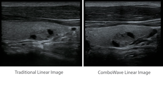 Mindray DC-60 ECHO Ultrasound System with X-Insight Technology for Enhanced Imaging and Clinical Efficiency
