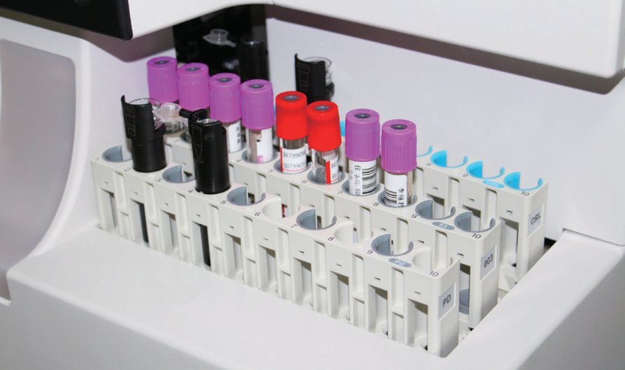 Mindray H50 Automated HPLC Analyzer for HbA1c Testing - High Precision and User-Friendly