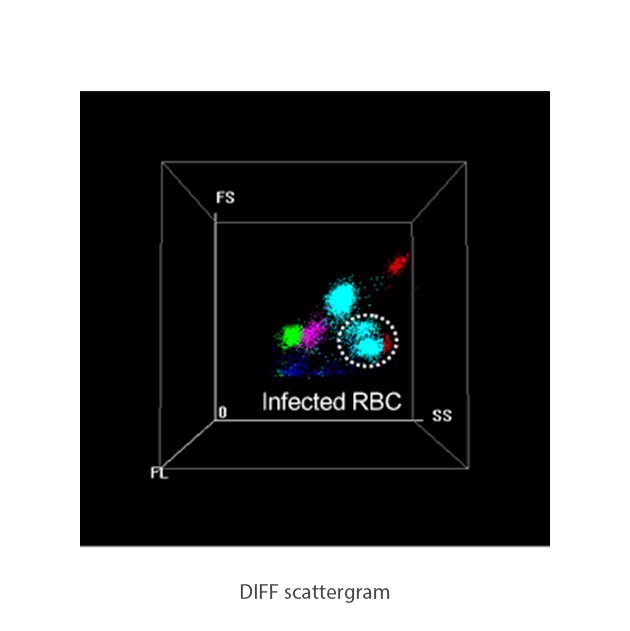 BC-6800 Auto Hematology Analyzer with SF Cube Technology for Advanced Blood Cell Analysis