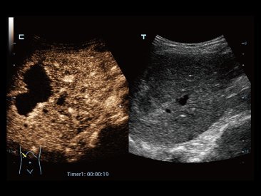 Mindray Resona 7 Premium Ultrasound System with ZONE Sonography Technology and Advanced Imaging Features