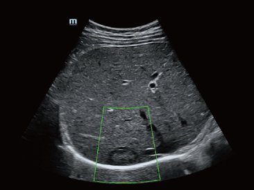 Mindray Resona 7 Premium Ultrasound System with ZONE Sonography Technology and Advanced Imaging Features