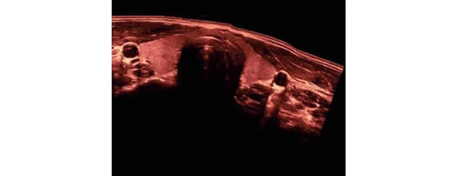 Z50 Color Doppler Ultrasound Machine