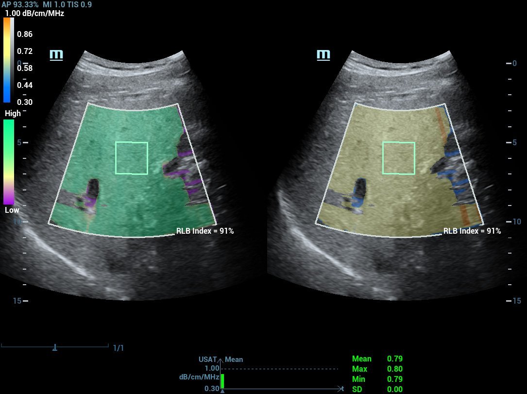 Resona R9 Platinum Edition Premium Ultrasound System for Radiology and Multi-Parametric Imaging Solutions
