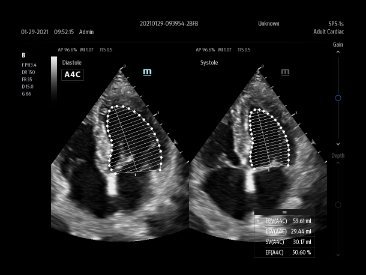 DC-80A Ultrasound System - High Clarity Imaging and Advanced Transducer Technology