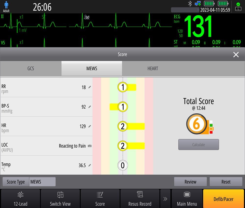 BeneHeart DX Defibrillator/Monitor - Advanced Emergency Medical Device