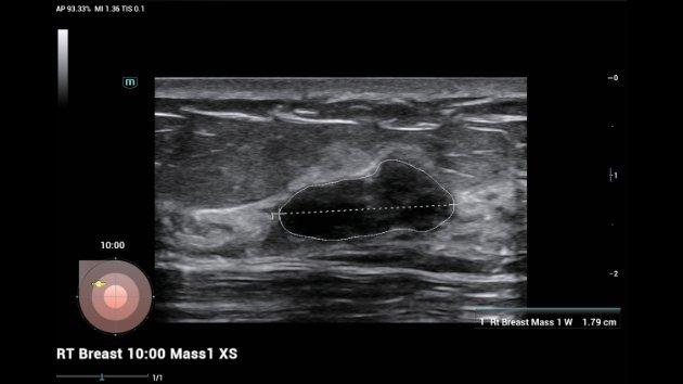 Consona N8 Diagnostic Ultrasound System - Advanced Imaging Solutions for Healthcare Professionals