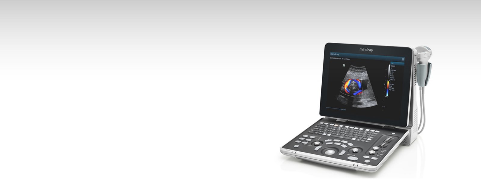 Z50 Color Doppler Ultrasound Machine