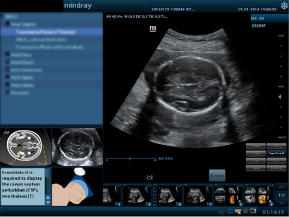 DC-30 FullHD Ultrasound System for Enhanced Diagnostic Imaging