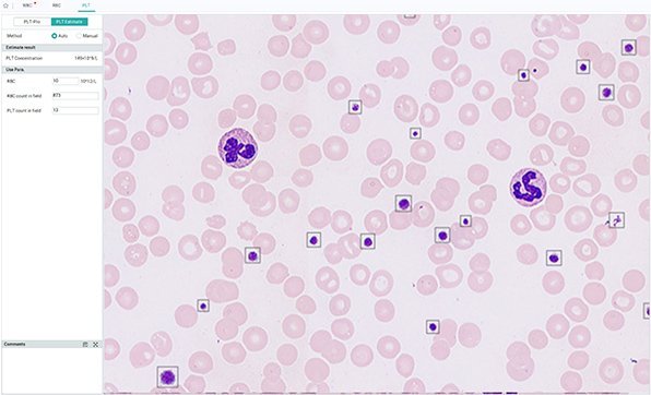 MC-80 Automated Digital Cell Morphology Analyzer - High-Resolution Blood Cell Analysis Device