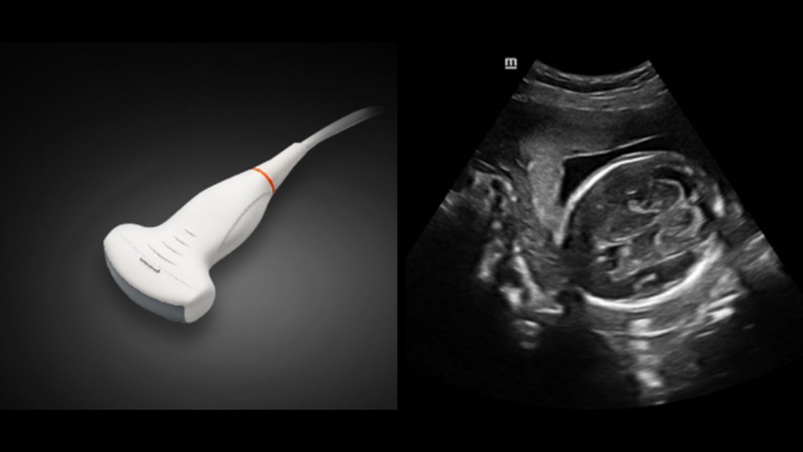 DC-40 Diagnostic Ultrasound System – Pure Crystal Technology for Primary Care