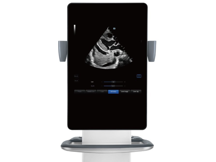 TE9 Ultrasound System for Anesthesia and Critical Care