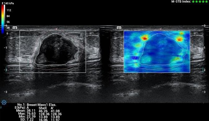 Resona I8 Diagnostic Ultrasound System