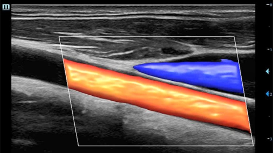 DC-80A Ultrasound System - High Clarity Imaging and Advanced Transducer Technology