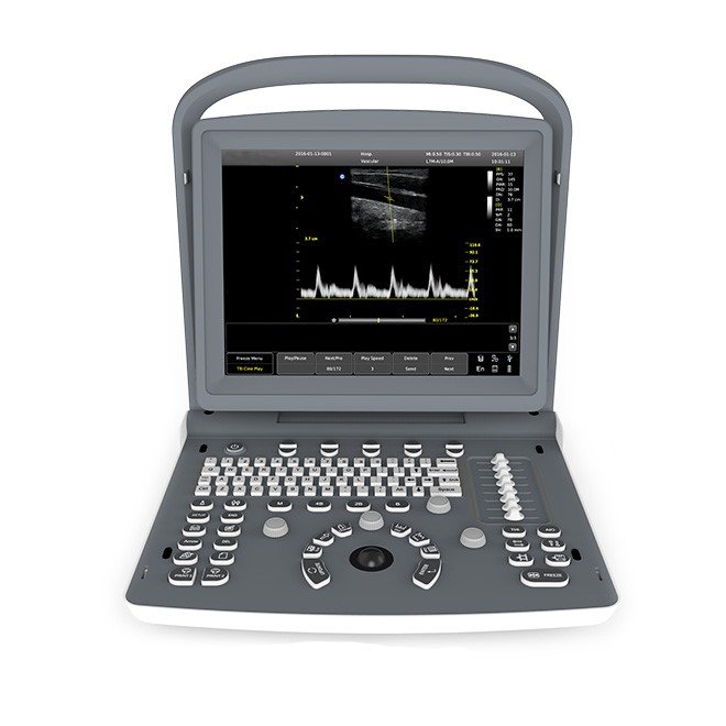 Musculoskeletal Ultrasound ECO2